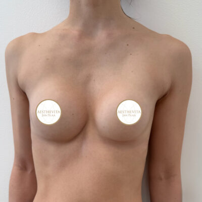 mia-femtech-005-po
