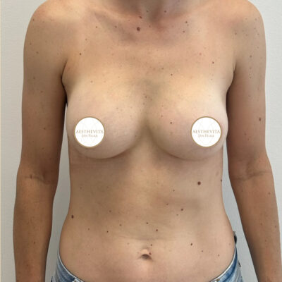 mia-femtech-025-po