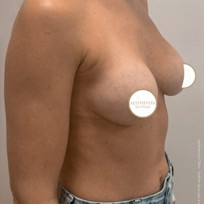 mia-femtech-031-po