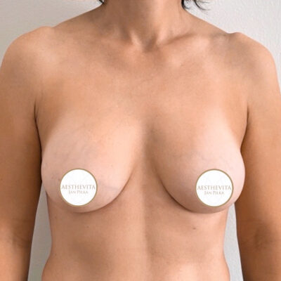 mia-femtech-033-po