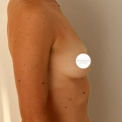 mia-femtech-039-pred