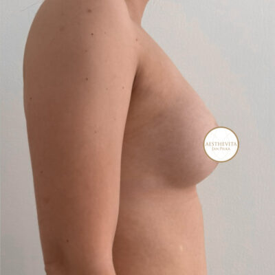 mia-femtech-042-po