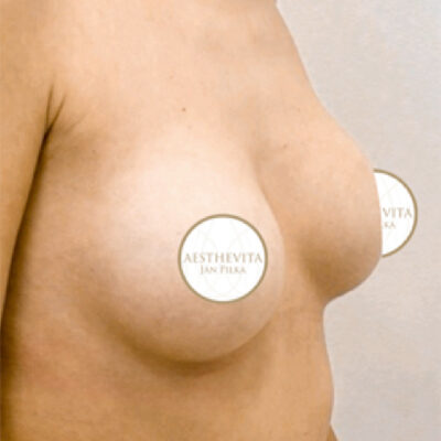 mia-femtech-059-po