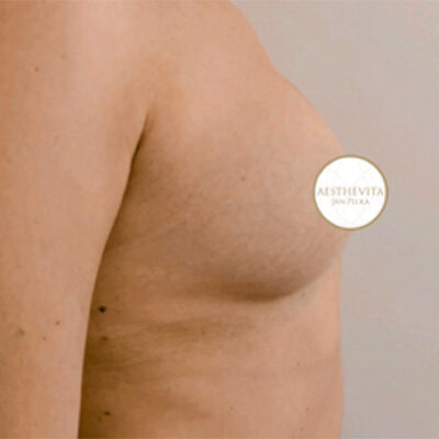 preserve-18-po