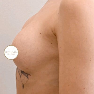 mia-femtech-061-po